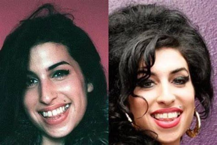 Amy Winehouse's Teeth: A Unique Reflection of Her Life and Legacy