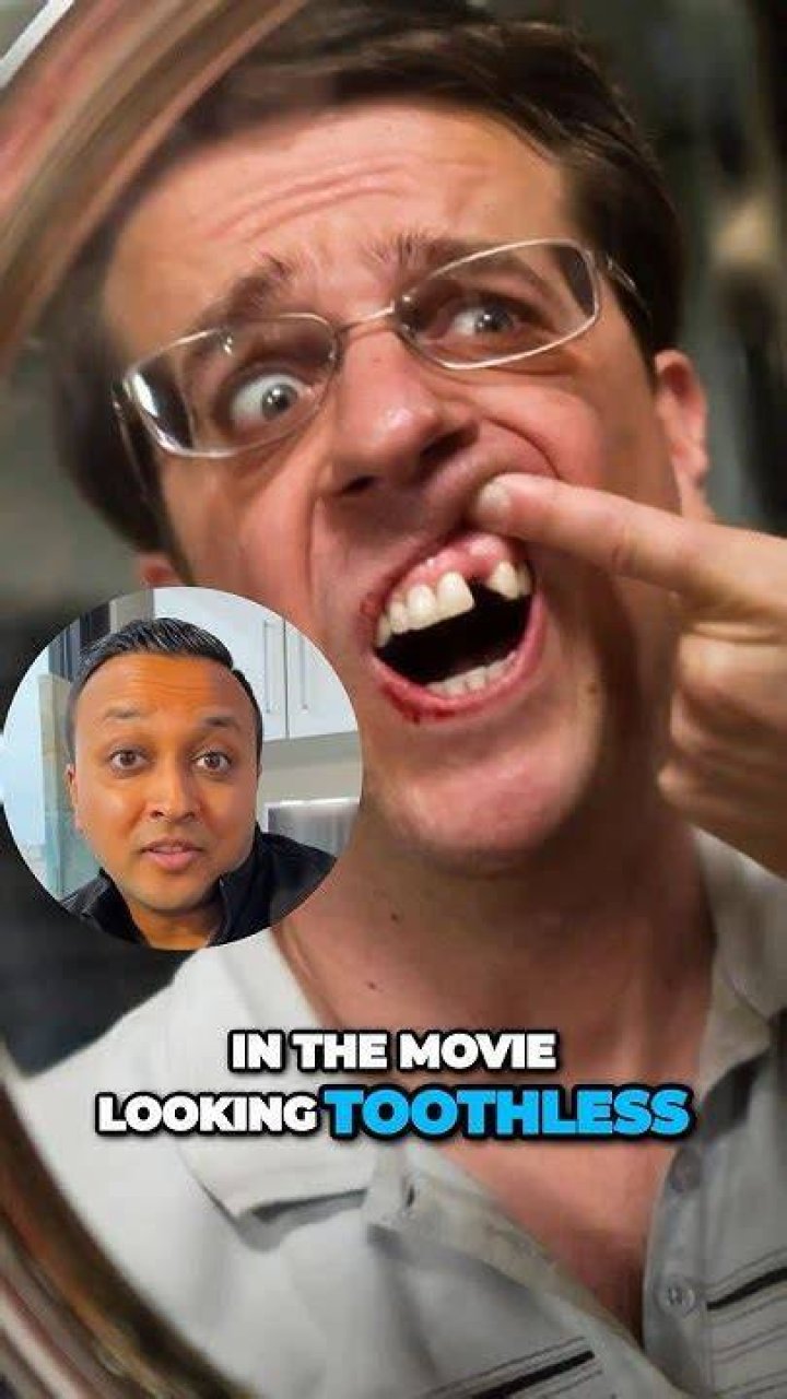 Dentist The Hangover: A Deep Dive into the Iconic Character and His Impact on Pop Culture