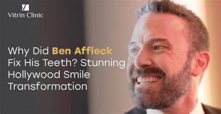 Did Rex Linn Get His Teeth Fixed? The Truth Behind the Smile