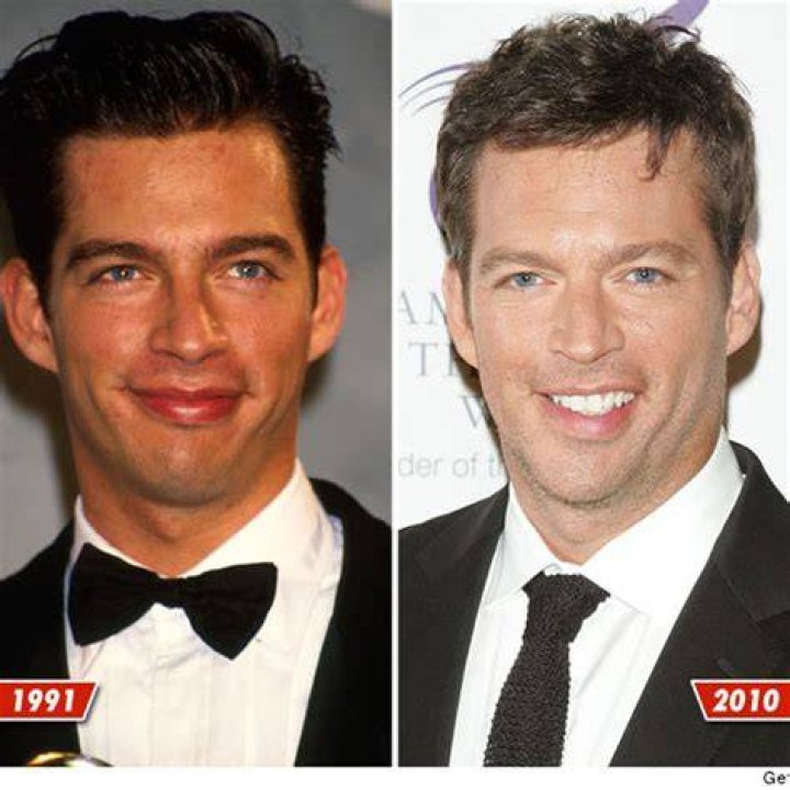 Harry Connick Jr: The Stroke That Changed Everything