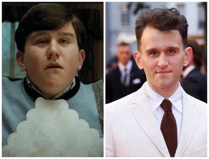 Harry Melling: From Child Star to Acclaimed Actor