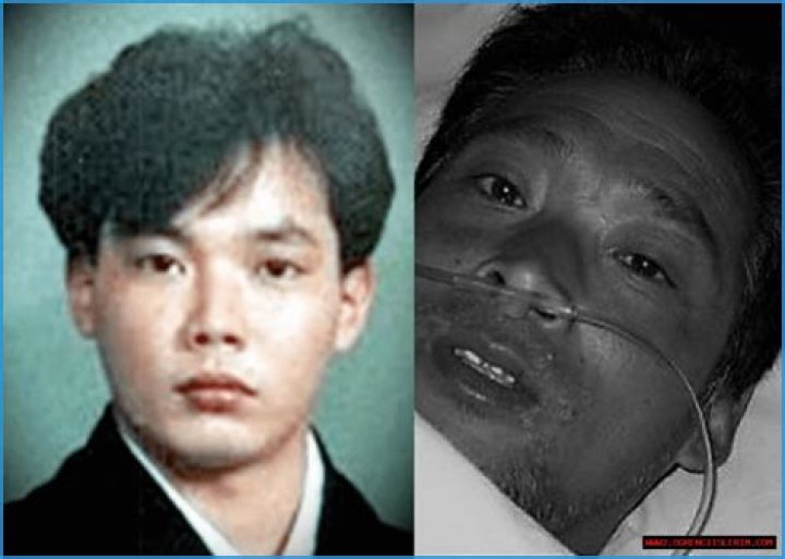 Hisashi Ouchi Photos: A Deep Dive into the Life and Legacy of a Tragic Figure