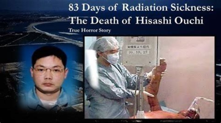 Hisashi Ouchi Real Body Photo: The Tragic Story Behind the Images