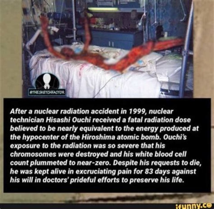 Hisashi Ouchi Real Photos from Hospital: A Deep Dive into a Tragic Story