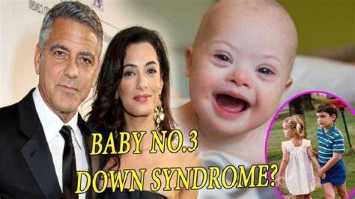 Is One of George Clooney's Twins Have Down's Syndrome?