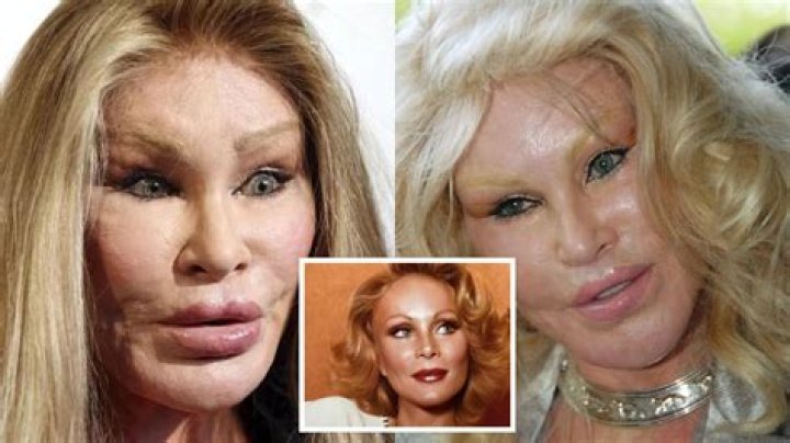 Jocelyn Wildenstein Before Surgeries: The Transformation of a Controversial Icon