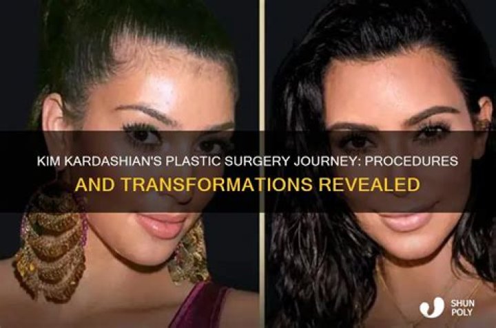 Kim Kardashian's Plastic Surgery Journey: A Comprehensive Guide