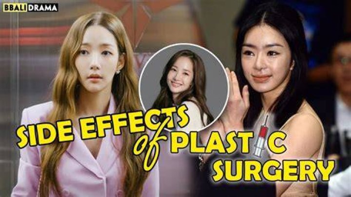 Kim Soo Hyun Plastic Surgery: Unveiling the Truth Behind the Transformation