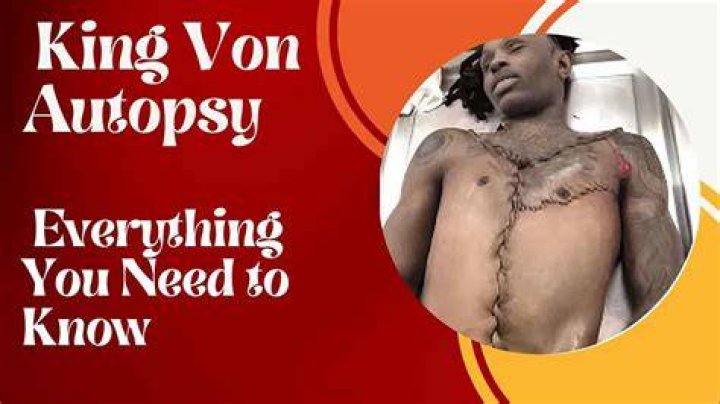 King Von Autopsy: A Comprehensive Analysis of His Life and Tragic Demise
