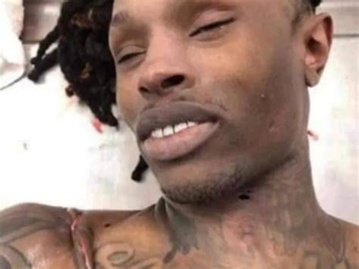 King Von Autopsy Photo: A Deep Dive Into the Controversial Images