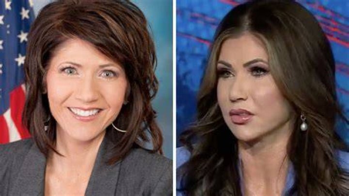 Kristi Noem Before Cosmetic Surgery: An In-Depth Look