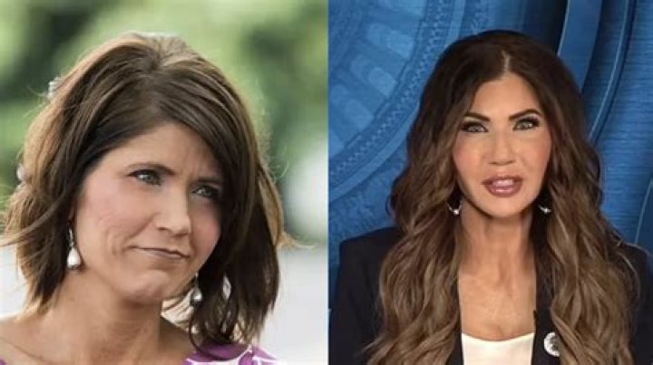 Kristi Noem Before Plastic Surgery: A Journey Through Transformation