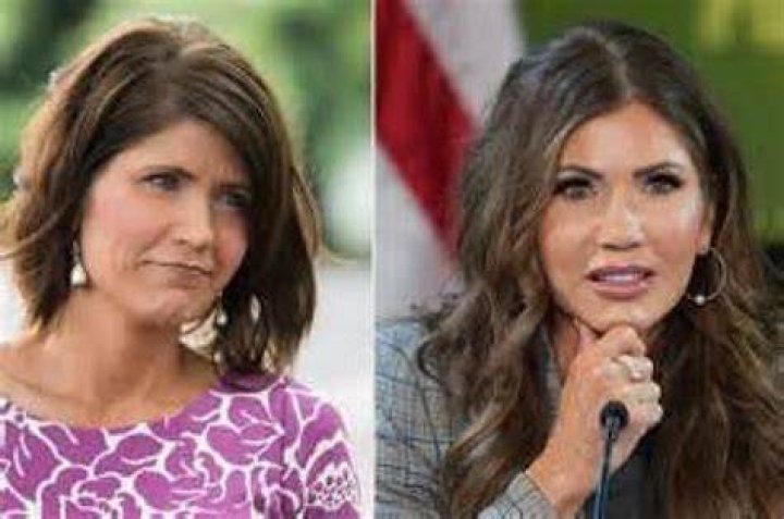 Kristi Noem Fillers: Exploring the Truth Behind the Rumors