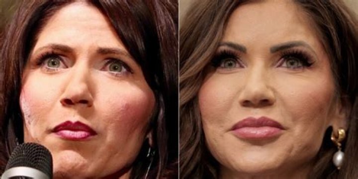 Kristi Noem: The Truth Behind Her Plastic Surgery Journey