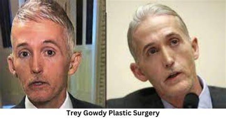 Trey Gowdy and the Rumors of Plastic Surgery: A Closer Look