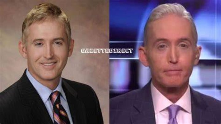 Trey Gowdy's Transformation: The Truth Behind His Nose Surgery