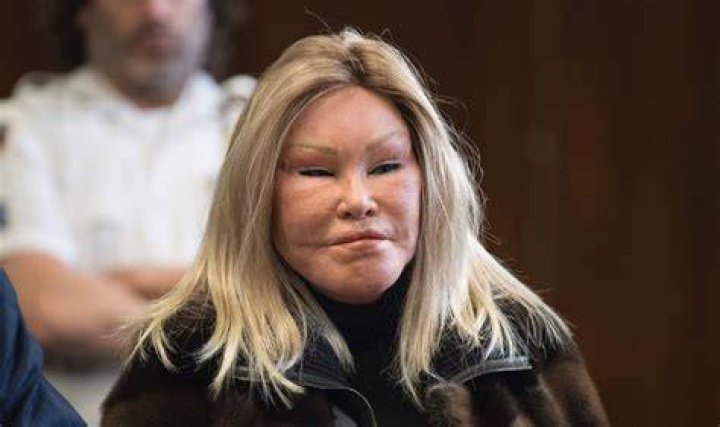 Unveiling the Life of Jocelyne Wildenstein: The Catwoman of New York