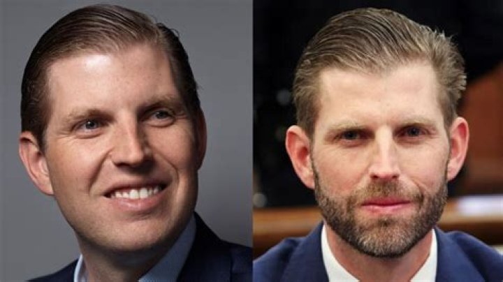 Unveiling the Truth: Eric Trump and His Plastic Surgery Journey