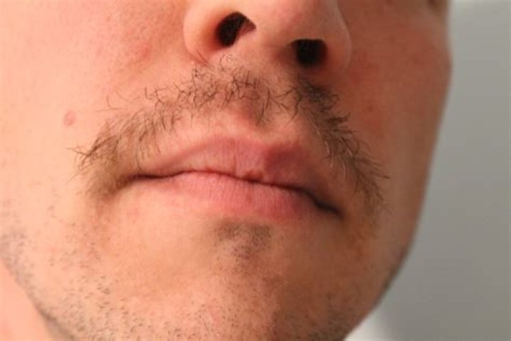Why Is My Mustache Not Growing Thick?